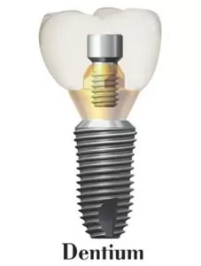 Hệ thống Implant sử dụng Dentium Implant