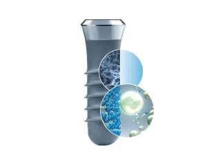 Hệ thống Implant sử dụng Implant Straumann