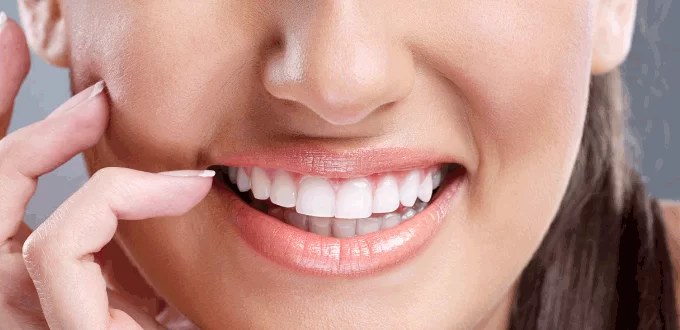 Tẩy trắng răng có an toàn không? Tẩy trắng răng cực kỳ an toàn