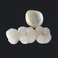 Các loại răng sứ Ivoclar-Vivadent