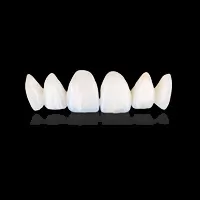 Các loại răng sứ Nano-Emax là 1 trong các loại răng sứ phổ biến hiện nay