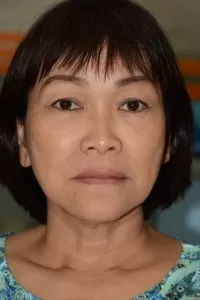 Một ca lâm sàng All on 4 anh-benh-nhan-nha-khoa-drhung