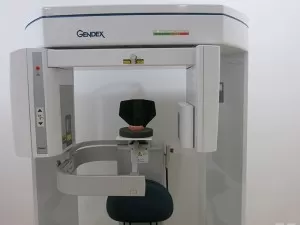 Một ca lâm sàng All on 4 chup-CT--drhung-dental