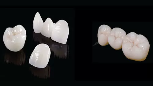 Răng sứ thẩm mỹ - thay đổi nụ cười ngoạn mục Răng sứ thẩm mỹ giải pháp hoàn hảo thay đổi nụ cười ngoạn mục.