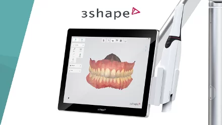 5 điều chưa biết về niềng răng Invisalign không mắc cài Niềng răng Invisalign