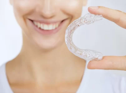 5 điều chưa biết về niềng răng Invisalign không mắc cài Niềng răng Invisalign