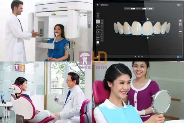 LÝ DO VIỆT KIỀU VỀ VIỆT NAM LÀM RĂNG THẨM MỸ NGÀY CÀNG NHIỀU Cơ sở vật chất ngang tầm thế giới
