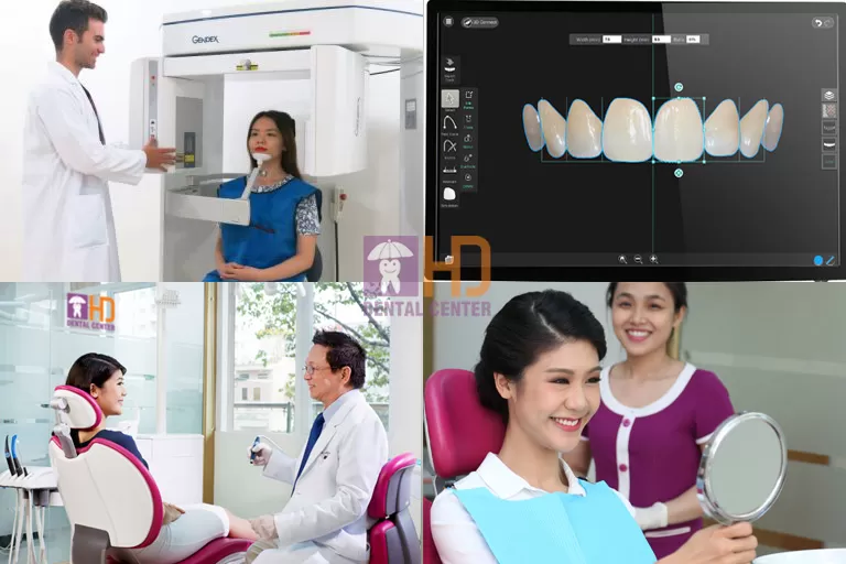 CƯỜI HỞ LỢI VÀ NHỮNG SỰ THẬT LIÊN QUAN TƯỚNG SỐ cười hở lợi
