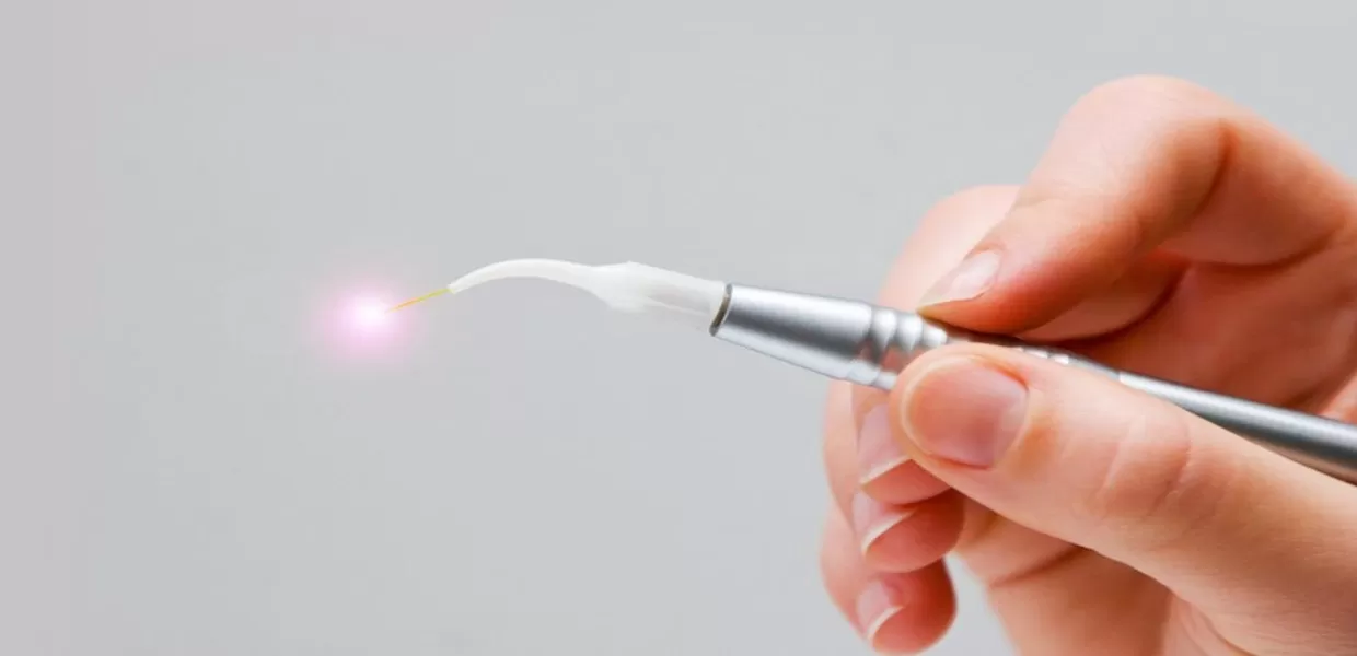 Áp dụng Laser cho điều trị nào? Áp dụng Laser cho điều trị nào?