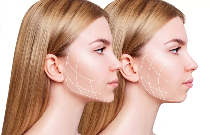 PHẪU THUẬT CHỈNH HÔ Phau thuat ham ho
