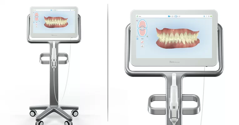 7 LÝ DO BẠN NÊN ĐIỀU TRỊ INVISALIGN TẠI Kubet WORLDWIDE Thấy trước kết quả điều trị