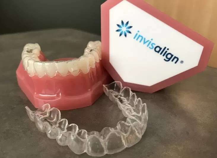 Khay niềng răng invisalign trong suốt, mềm dẻo, vừa bảo đảm thẩm mỹ vừa tạo cảm giác dễ chịu, ít vướng víu. Invisalign là gì?