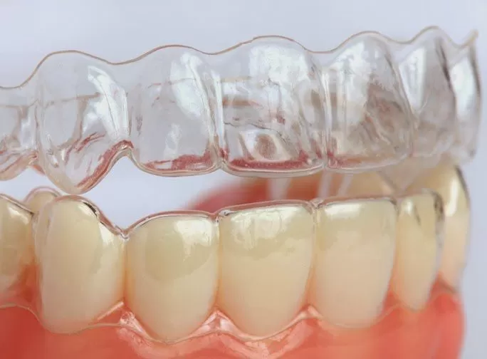 Chỉnh nha Invisalign khác gì so với niềng mắc cài? Khay chỉnh nha Invisalign được làm bằng vật liệu SmartTrack® mềm dẻo, dễ tháo lắp