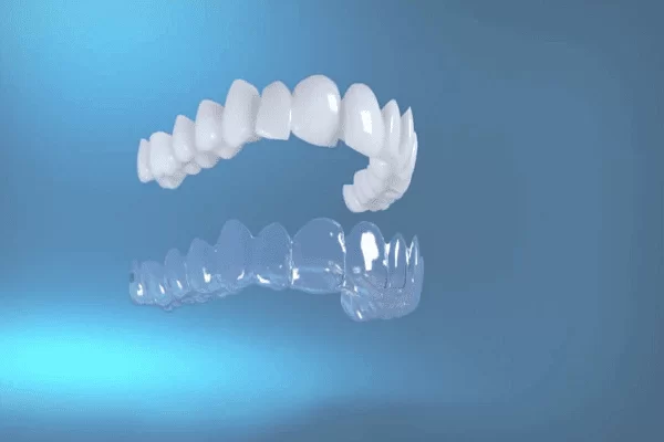 4 điểm đặc biệt cần lưu ý khi niềng Invisalign Khay niềng Invisalign được sản xuất độc quyền tại Mỹ