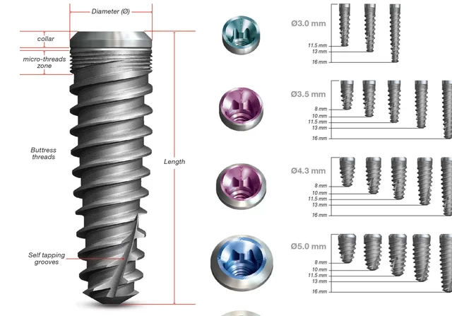 Trồng răng với công nghệ Implant: nha khoa nào tốt nhất? công nghệ Implant - IMPLANT HAHN