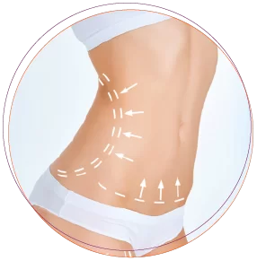 Bảng giá hút mỡ Ultrasonic Liposuction