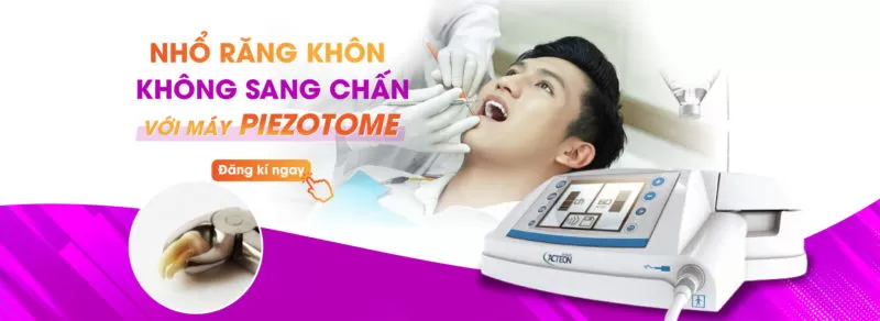 “TIỄN” RĂNG KHÔN TẠI Kubet WORLDWIDE Nhổ răng khôn không sang chấn tại Kubet Worldwide
