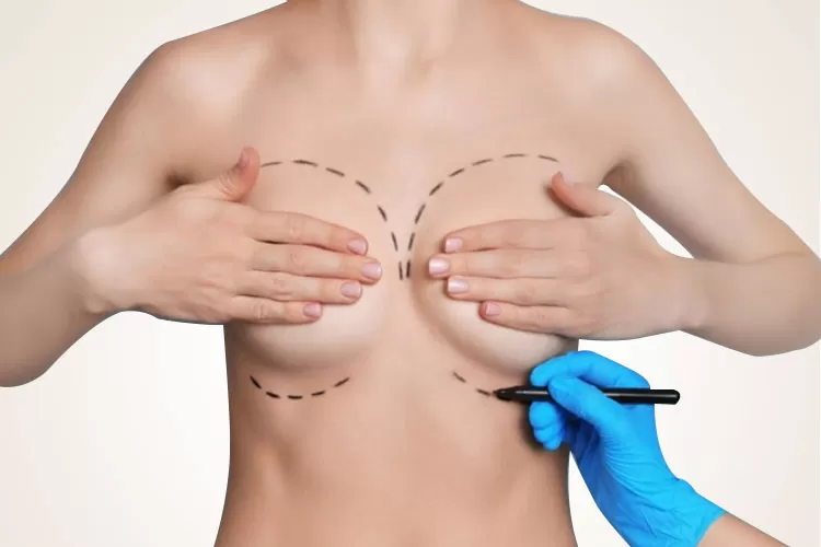 Nâng ngực không phẫu thuật ở đâu uy tín? Vẽ dáng ngực thử