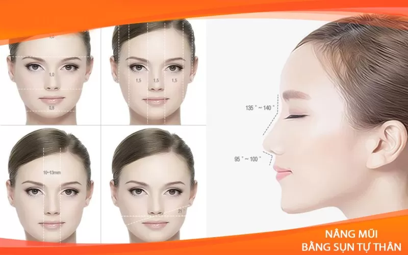 Những dịch vụ thẩm mỹ nâng mũi hiện nay Thẩm mỹ nâng mũi bằng sụn tự thân