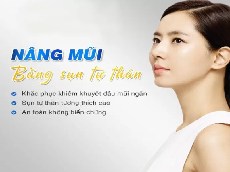 Ưu Điểm Và Nhược Điểm Của Nâng Mũi Bằng Sụn Tự Thân Nâng mũi bằng sụn tự thân hoàn toàn