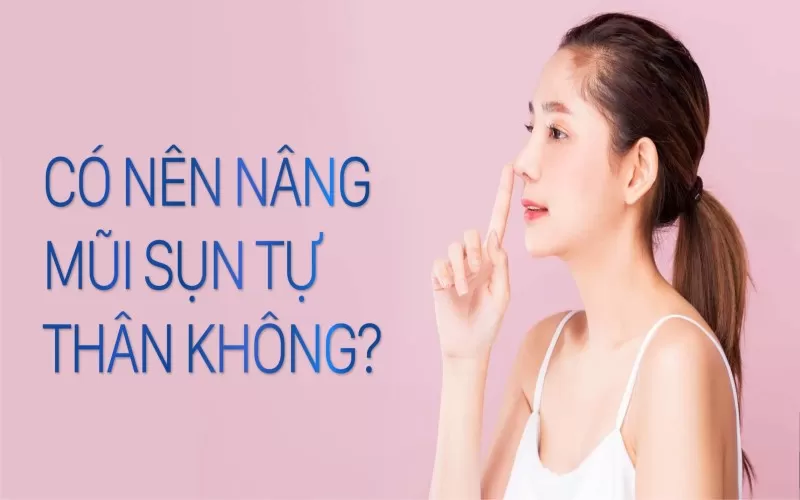 Ai Nên Nâng Mũi Bọc Sụn Tự Thân? Nâng mũi bọc sụn tự thân có tốt không?