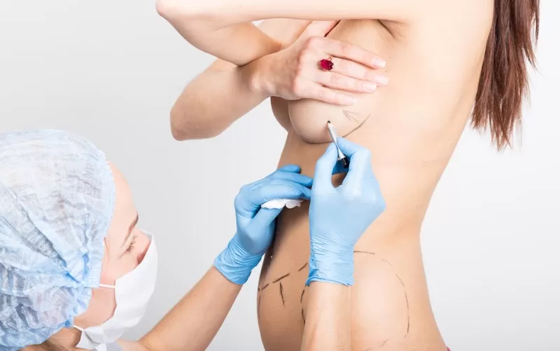 Nâng ngực không cần phẫu thuật - Sự thật cần phải biết Nâng ngực bằng phương pháp cấy mỡ tự thân