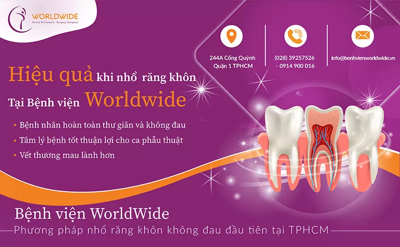 Nhổ răng khôn tại Kubet Worldwide không đau Nhổ răng khôn tại Kubet Worldwide