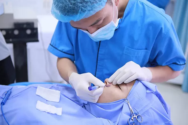 Phẫu thuật thu nhỏ cánh mũi tự nhiên cho phái đẹp Phẫu thuật thu nhỏ cánh mũi hoàn hảo cho phái đẹp