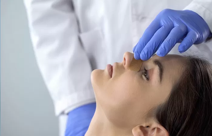 Mũi tẹt là gì? Những cách sửa mũi tẹt hiệu quả nhất cach sua mui tet