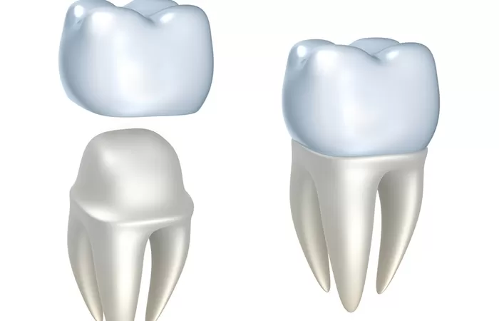 Các phương pháp bọc răng sứ hiện nay – Cập nhật 2021 cac phuong phap bọc rang su hien nay