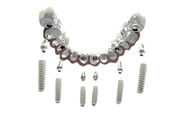 Trồng răng implant - Giải pháp hàng đầu cho người mất răng lâu năm trong rang implant