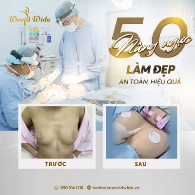 Phương pháp chăm sóc vòng một ngăn ngừa chảy xệ sau sinh ngực chảy xệ, thẩm mỹ ngực chảy xệ