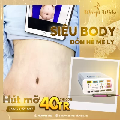 ƯU ĐÃI CỰC KHỦNG: SIÊU BODY ĐÓN HÈ MÊ LY khuyến mãi, khuyến mãi thẩm mỹ, thẩm mỹ mùa hè