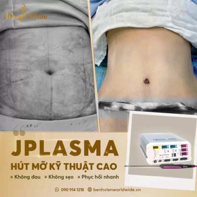 ƯU ĐÃI CỰC KHỦNG: SIÊU BODY ĐÓN HÈ MÊ LY hút mỡ an toàn, khuyến mãi thẩm mỹ, thẩm mỹ mùa hè