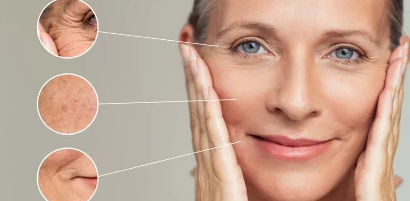 Ultherapy và Thermage: so sánh trẻ hóa da bằng 2 công nghệ được ưa chuộng nhất làn da bị lão hóa