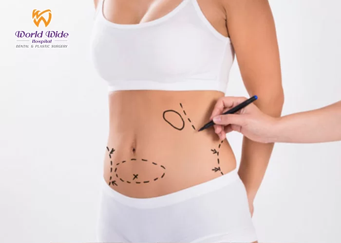 Bảng giá hút mỡ hút mỡ siêu âm