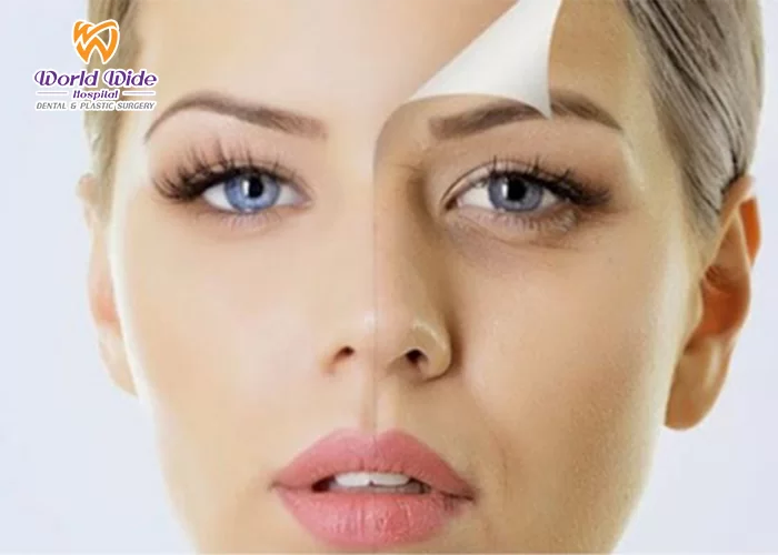 Bảng giá hút mỡ lấy mô bọng mắt dưới