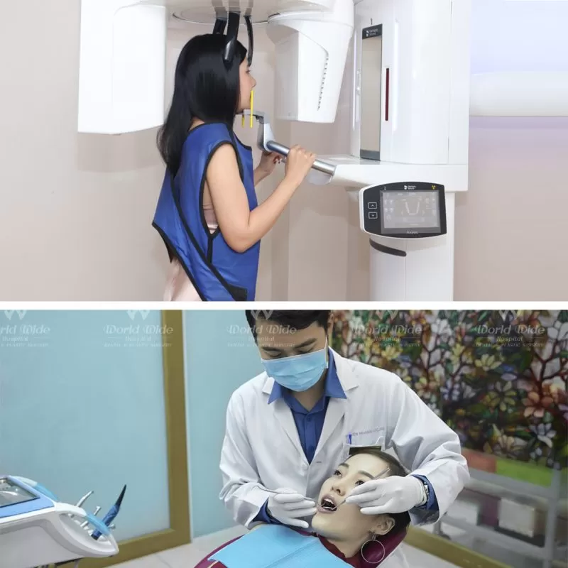 Quy trình cấy ghép Implant thăm khám