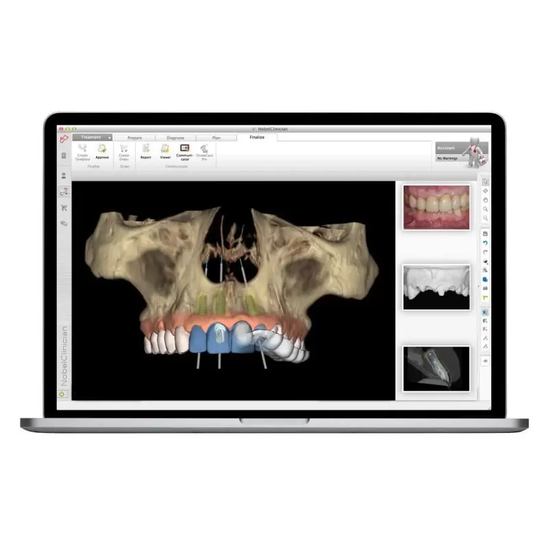 TRỒNG RĂNG IMPLANT TOÀN HÀM phần mềm phân tích