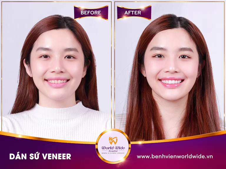 Gallery Đinh Nguyễn Mai Phương bf - at - min