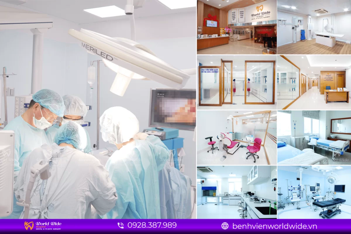 6 BEST BENEFITS OF PTERYGOID IMPLANT Implant chân bướm hình b3.2-min
