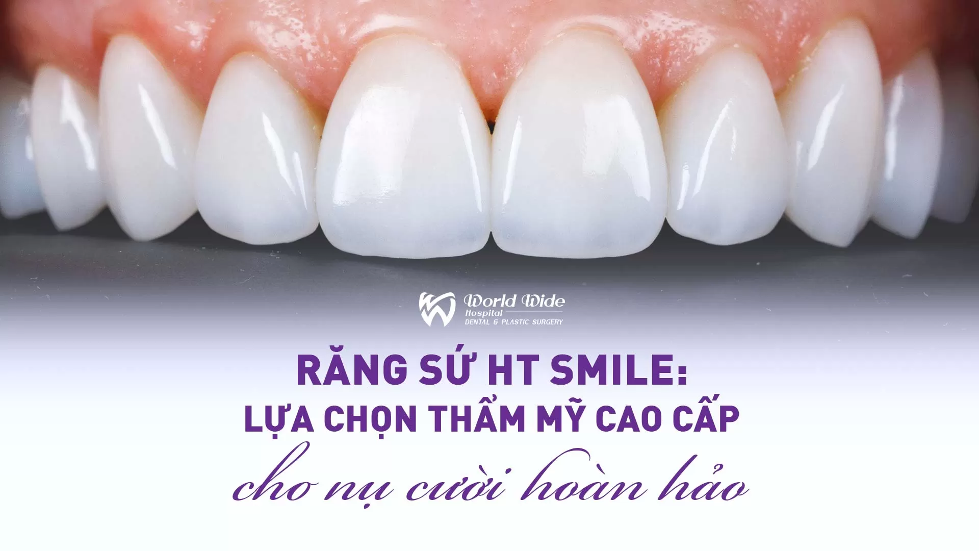 RĂNG SỨ HT SMILE: LỰA CHỌN THẨM MỸ CAO CẤP CHO NỤ CƯỜI HOÀN HẢO