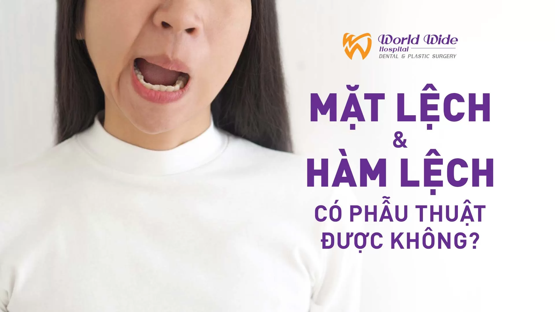 MẶT LỆCH, HÀM LỆCH CÓ PHẪU THUẬT ĐƯỢC KHÔNG?