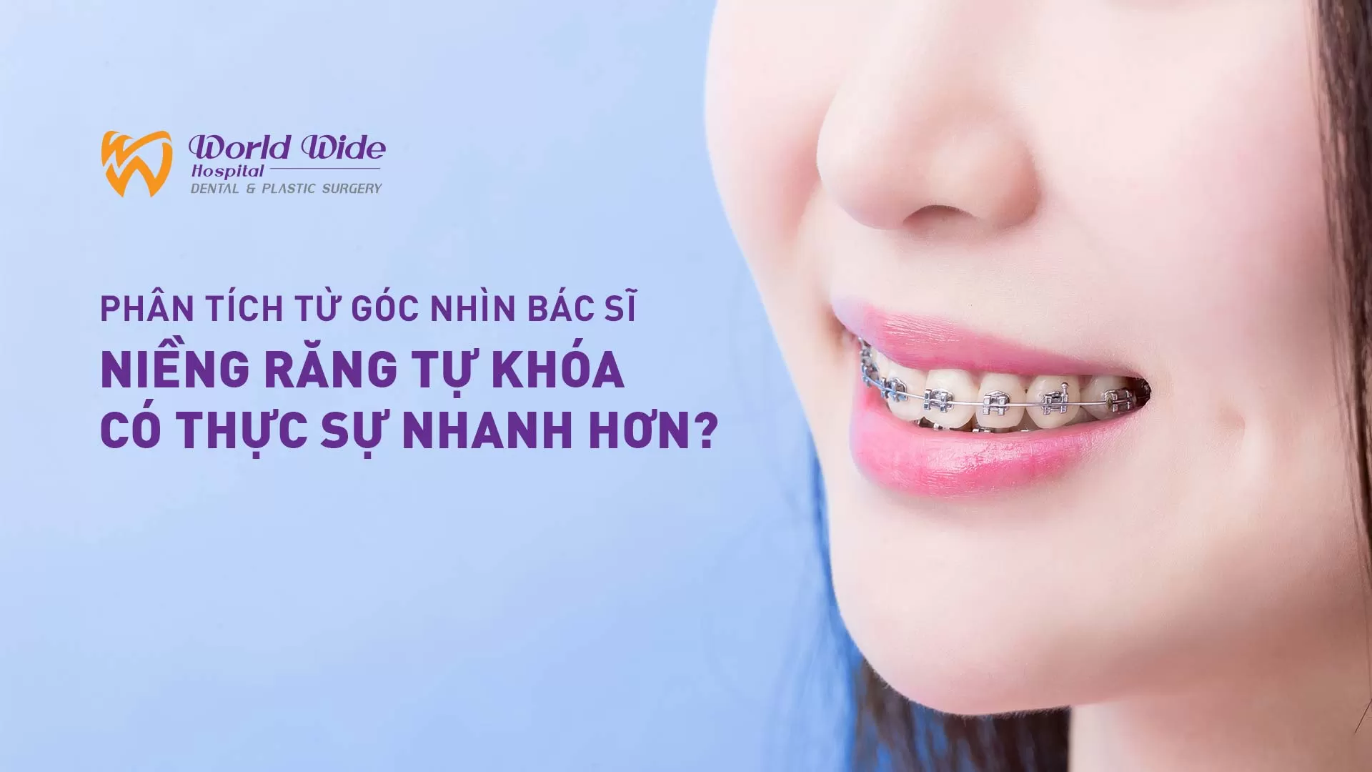 NIỀNG RĂNG TỰ KHÓA CÓ THỰC SỰ NHANH HƠN? PHÂN TÍCH TỪ GÓC NHÌN BÁC SĨ