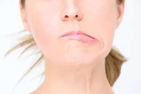 MẶT LỆCH, HÀM LỆCH CÓ PHẪU THUẬT ĐƯỢC KHÔNG?