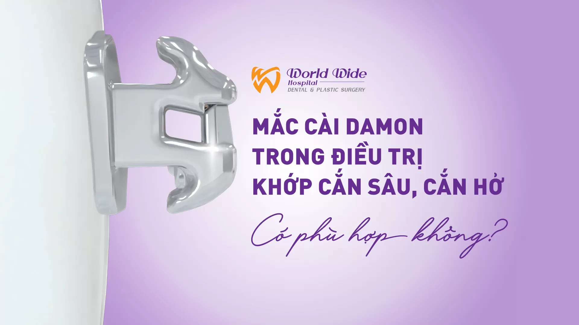 MẮC CÀI DAMON TRONG ĐIỀU TRỊ KHỚP CẮN SÂU, CẮN HỞ – CÓ PHÙ HỢP KHÔNG?